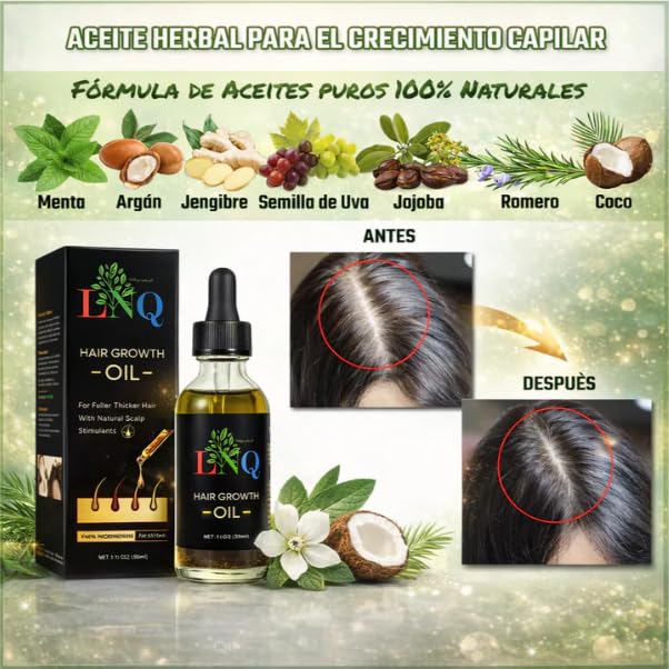 Aceite Capilar Herbal LNQ – Fórmula Natural para Crecer, Fortalecer y Engrosar el Cabello