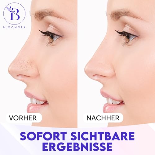 Mitesserentferner Stripes – Nasenstrips Mitesser und Nose Strips Blackhead – Pore Strips und Mitesser Pflaster zur sanften Entfernung von Mitessern (12 Stück)