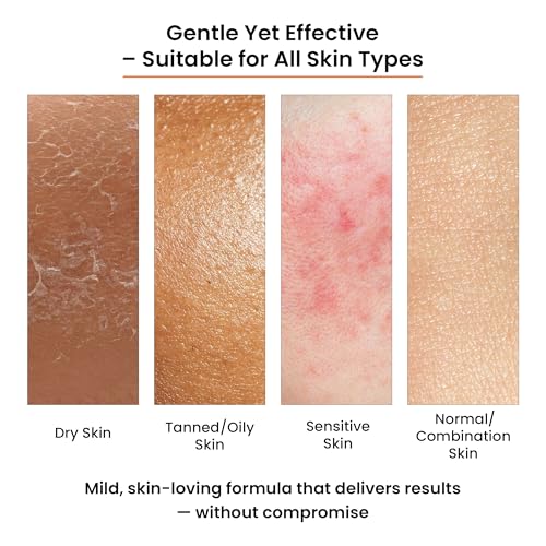 Image of WildOak Brightening & DeTan Body Soap | Pack of 1 x 3 pcs | Cold Pressed Premium Soap for Gentle Exfoliation, Dark Spots & Pigmentation Repair with Kojic Acid, Alpha Arbutin, Niacinamide & Vitamin C