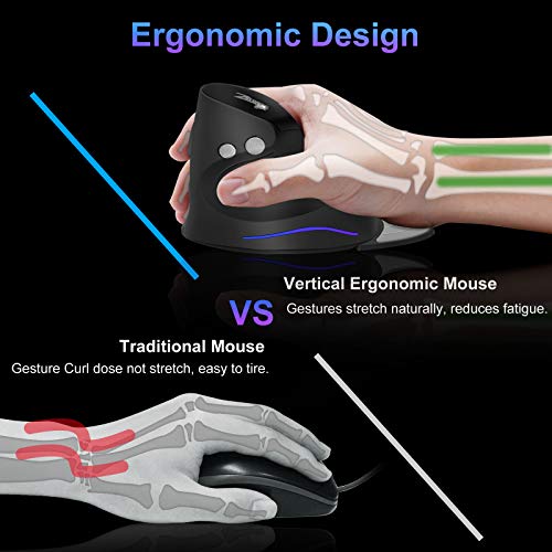 Image of TRELC 2.4G Wireless Ergonomic Optical Mouse with Adjustable Sensitivity (1000 /1600 /2400 DPI), Removable Palm Rest, Reduces Wrist Pain, 6 Buttons for PC, Desktop, Laptop (Wireless)