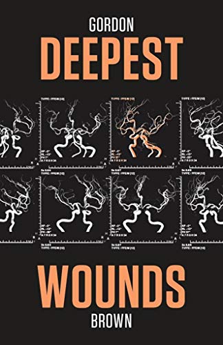 Deepest Wounds (McIntyre)