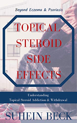 Topical Steroid Side Effects: Beyond Eczema and Psoriasis - Understanding Topical Steroid Addiction and Withdrawal (Skin Confessions Book 1)
