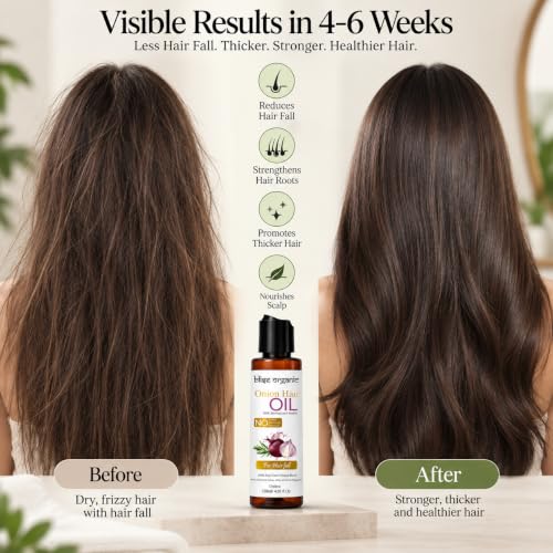 Image of Blise organic Onion hair Oil- Reduces Hair fall and Promotes Hair Growth