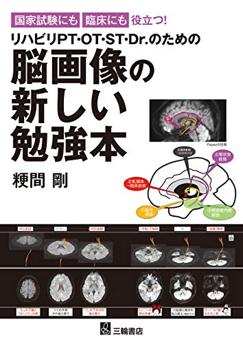 無料電子書籍 アプリ 国家試験にも臨床にも役立つ ! リハビリPT・OT・ST・Dr.のための脳画像の新 バイ
