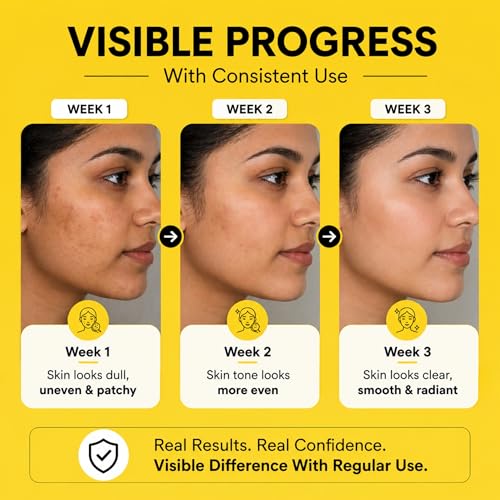 Image of Kojic Acid Soap For Skin Brightening | Tan Removal Soap Men and Women | Pack Of 3 (375g) | Pigmentation & Dark Spot Removal Bar with Vitamin E, Coconut Oil, Shea Butter & Olive Oil | Handmade | Skin Whitening | Kojic Acid Bar Bath