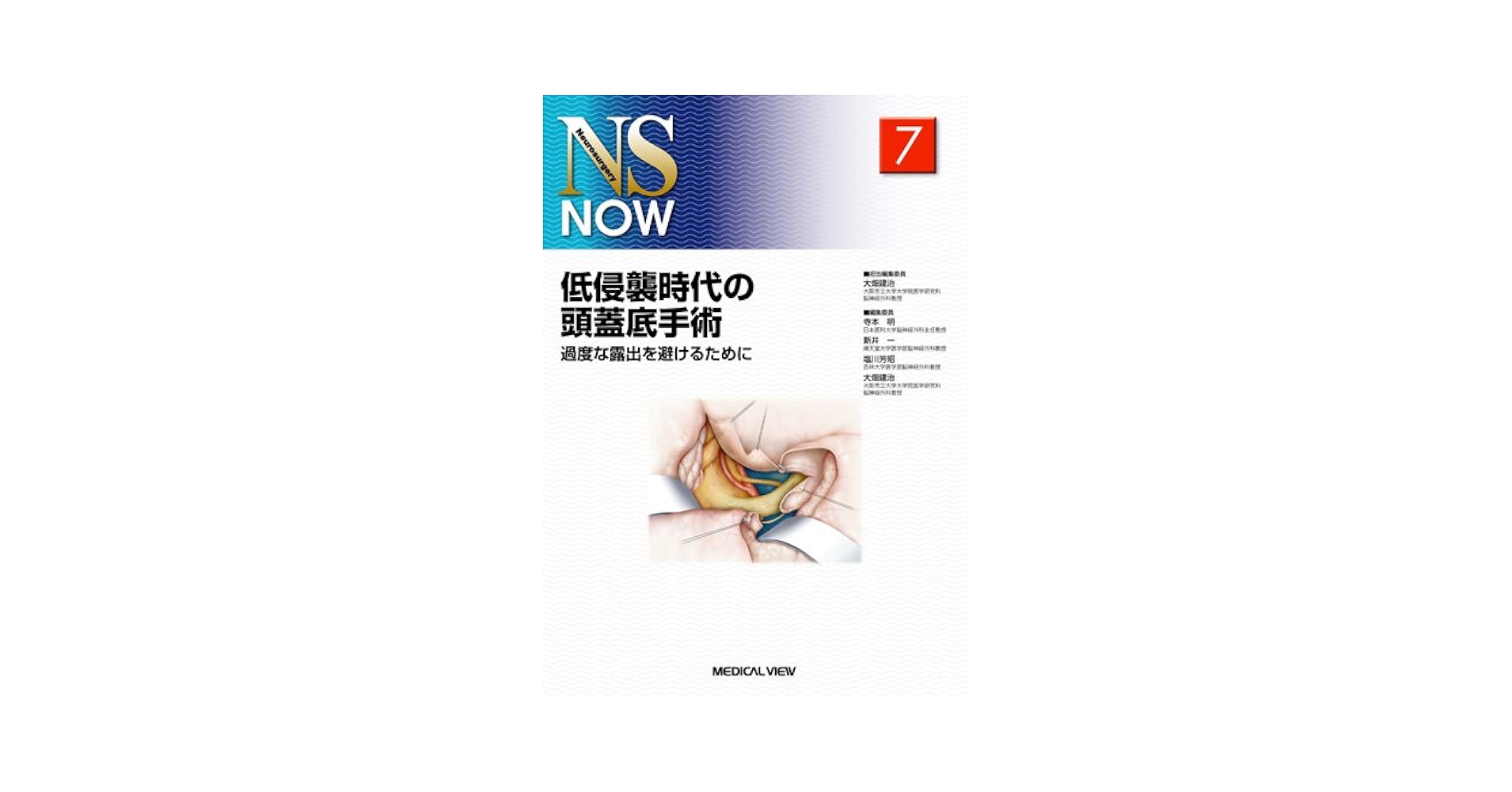 低侵襲時代の頭蓋底手術?過度な露出を避けるために (NS NOW No.7) [単行本] 大畑 建治 低侵襲時代の頭蓋底手術−過度な露出を避けるために (NS NOW No