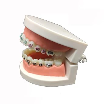 Explaining Models with Braces - Patient Communication Lab Teach Study Tools - Dental 11 Demonstration Orthodontic Treatment Teeth Model Metal Braces with Archwire
