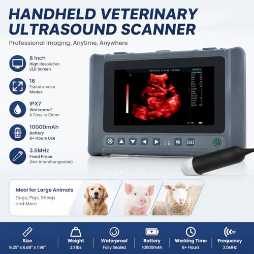ultrasound machine 2026 29