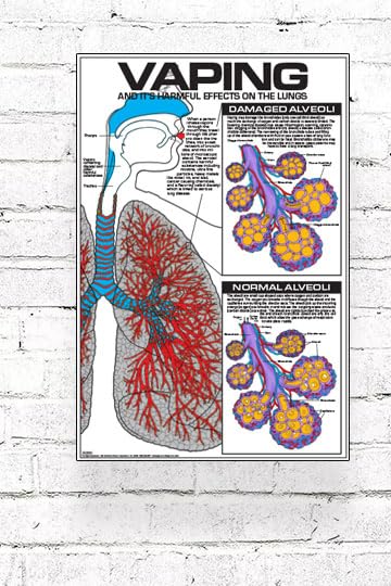 healthy lungs vs vapers lungs Vaping Possible Negative Effects on Lungs: State-of-the-Art From Lung  Capacity Alteration to Cancer
