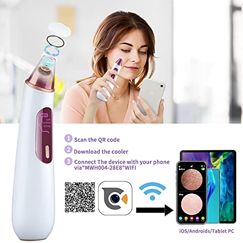 RaMokey Mitesserentferner Porenreiniger mit Kamera, Beauty Device Mitesser Entferner Porensauger, Visuell Mitesser… – Bild 4
