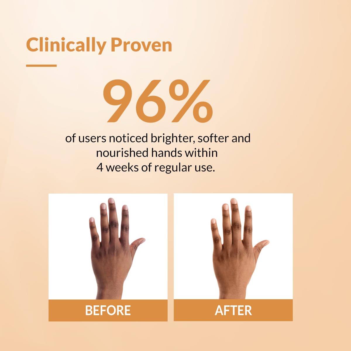 Fixderma Brightening Hand Cream for Women & Men | Hand Moisturizer | Kojic Acid Cream | Hand Cream for Dry and Rough Hands | Cream for Itchy Hand | Hand Cream with SPF 50 | All Skins Types - 30gm 4