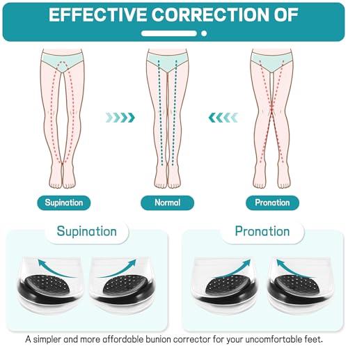 Bcckle 2Layers Adjustable Orthopedic Heel Wedge Inserts,Upgrade Poron Heel Pads Inserts,Max Anti-Shock Heel Cushion For Supination,Pronation Correction,Bow Legs thumb #4