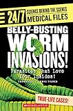 Belly-busting Worm Invasions! (24/7: Science Behind the Scenes: Medical Files)
