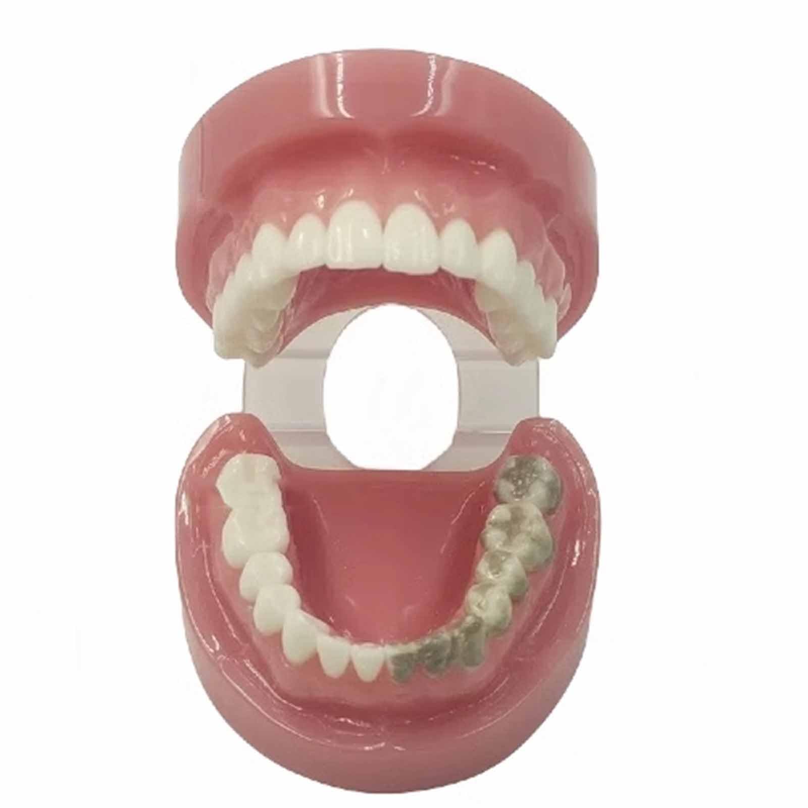 Model Zębów, Model Ekspozycyjny Z Nicią Dentystyczną, Do Nauki, Dla Dentystów, Studentów Stomatologii, Czysty Eksponat (Skóra 8 Cm),Flesh-8cm