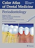 Periodontology (Color Atlas of Dental Medicine)