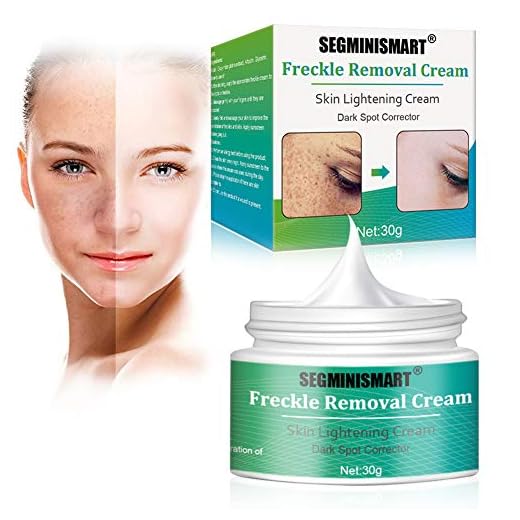 Crema Blanqueadora, Crema Antimanchas Facial Antiedad, Anti Manchas regeneradora y aclarante, tono de piel desigual, puntos oscuros y daños del sol, Crema Hidratante para la cara
