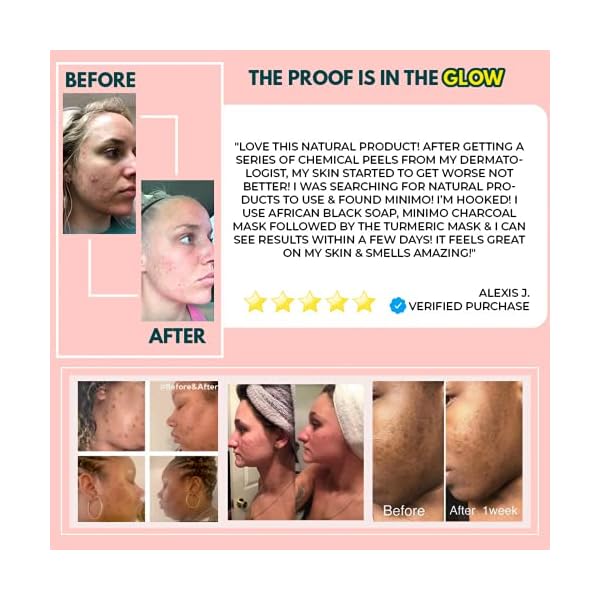 Minimo Glow Turmeric Face Scrub (ððð¦ð¨ð§ ððð¤ð) - Infused with Turmeric, Manuka Honey, Cinnamon, and Chamomile - Face Scrub for All Skin Types - Achieve Healthy Skin