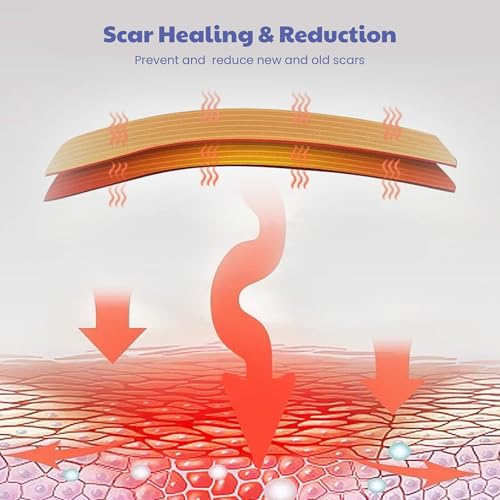 Image of Wipness Silicone Scar Sheets 61 inches (1.6 Meters) - Reusable & Flexible Medical Grade Tape for Surgical, C-Section, Burn, Acne, Keloid, Tummy Tuck & Hypertrophic Scar Removal Tape