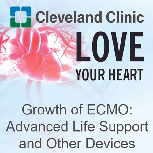 Growth of ECMO: Advanced Life Support and Other Devices cover art