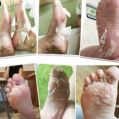 Aliver® Exfoliating Peeling with Papaya Extract Feet Foot Mask Socks Foot Care Renew Foot Dead Cracked Skin Corn Remover, Peel Away Calluses & Dead Skin Cell in 7 Days Fit Up to Size 11UK / 46EU