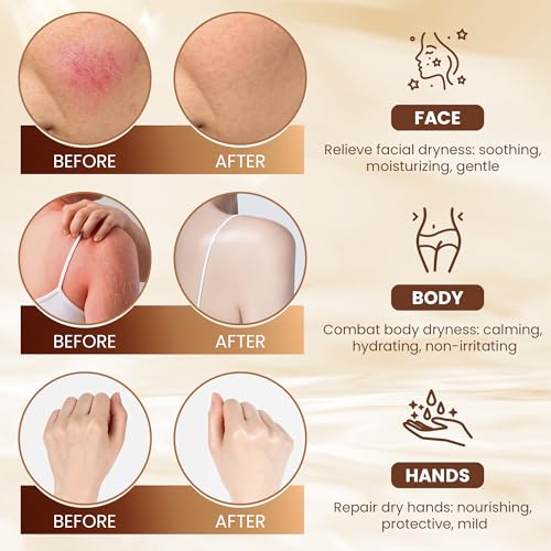 AAGJ Beef Tallow for Skin, 100% Organic Grass-Fed Beef Tallow Balm with Raw Honey - Moisturizing Cream for Face & Body, All Natural Moisturizer Skin Care for Soft, 4.2 Oz