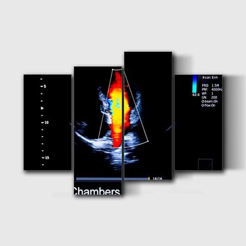 Imagen colorida del monitor de ultrasonido de corazón Homan, impresiones en lienzo, decoración de pared, 4 piezas, obras de arte enmarcadas