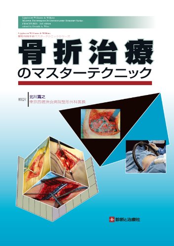 キンドル 無料電子書籍 骨折治療のマスターテクニック (整形外科手術マスターテクニックシリー バイ