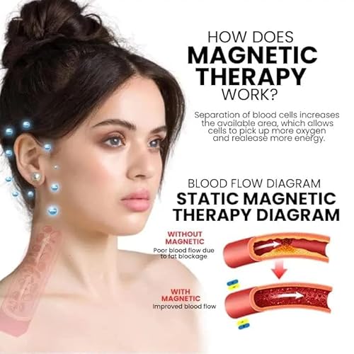 Elegance Lymphvity Magnetherapy White Onyx Earrings,2023 New Lymphatic Drainage Therapeutic Magnetic Ear Ornament,Non Piercing Magnetic Acupressure Earrings For Women Men (1 Pair) #TOP2