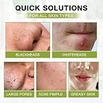SHVYOG Blackhead Peel Off Face Mask, 3-in-1 Blackhead Remover Mask with Brush & Tea Tree Oil Serum, Charcoal Mask for Deep Cleansing Dirts, Pores, Skin Oil (100g+30ml) - Image 5