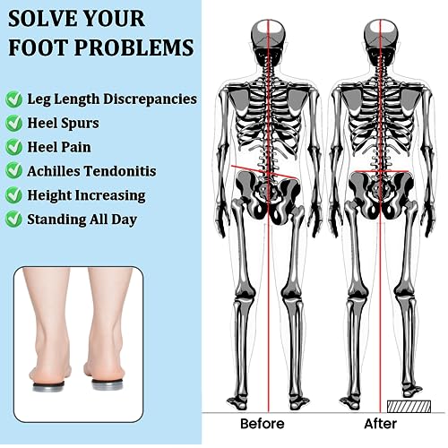 Image of JUMPOW Adjustable Orthopedic Shoe Lifts Inserts, 4 Layers Height Increase, Insoles for Uneven Legs, Leg Length Discrepancy, Heel Spurs & Pain, Sports Injuries, Achilles Tendonitis