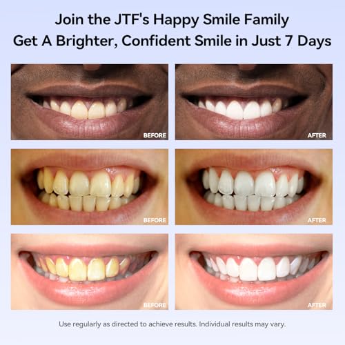JTF Portable Teeth Whitening Kit: LED Accelerator Light with 5 Whitening Gel and 1 Remineralization Gel, 35% Carbamide Peroxide, Battery Powered Teeth Whitener to Remove Stain for Brighter White Smile — view 5