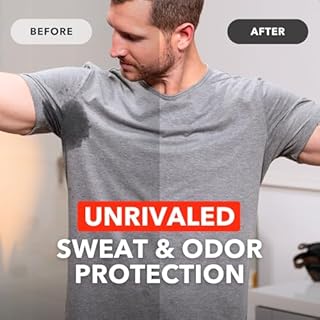 SweatBlock Clinical Strength Antiperspirant Wipes- Treat Hyperhidrosis & Excessive Sweating - Up to 7 Days Protection Per Wipe - 10 count - Unisex