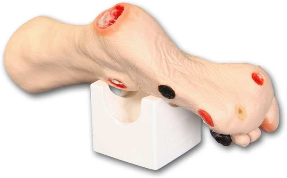 Wilma Wound Foot Model for Nursing and Healthcare Training - Realistic VATA Wilma Wound Foot Simulation for Pressure Ulcer and Wound Care, Flexible and Portable for Medical Students