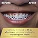 Waterpik Sensonic Complete Care Water Flosser and Rechargeable Electric Toothbrush Combo Set for Teeth Cleaning and Flossing, CC-04, White, Packaging May Vary