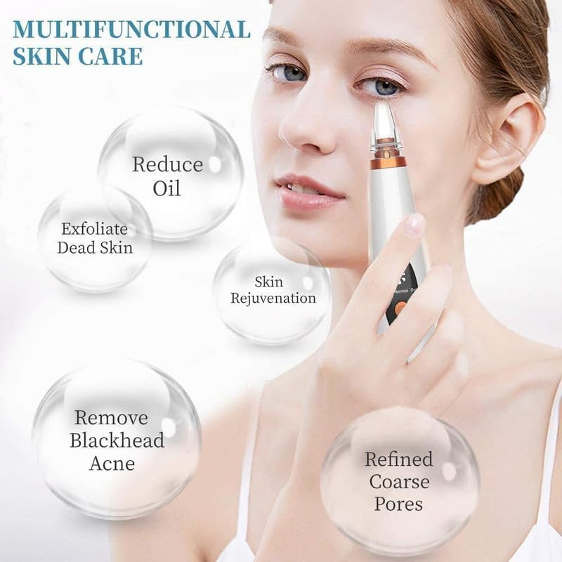 Image of Blackhead Remover Pore Vacuum - Electric Microdermabrasion Machine Black Head Cleaning Tool Pimple Sucker & Facial Cleanser Device for Pores Acne Nose Skin