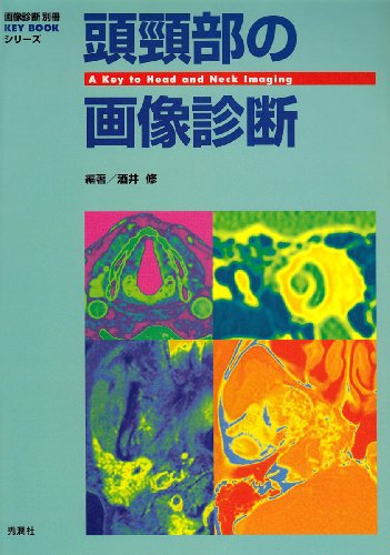 無料電子書籍 おすすめ 頭頚部の画像診断 (『画像診断』別冊KEY BOOKシリーズ) バイ