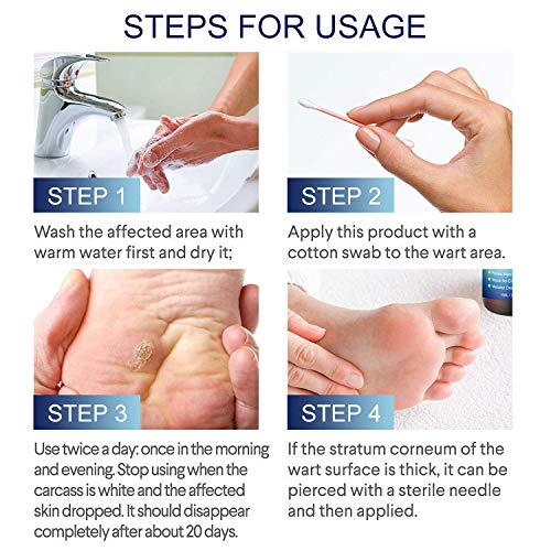 Wart Removal, Corn Removal, Painless Removal of Plantar, Common Warts and Infections, Promotes The Healing of Calluses and Corns(10ml)