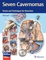 Seven Cavernomas: Tenets and Techniques for Resection 1684204941 Book Cover