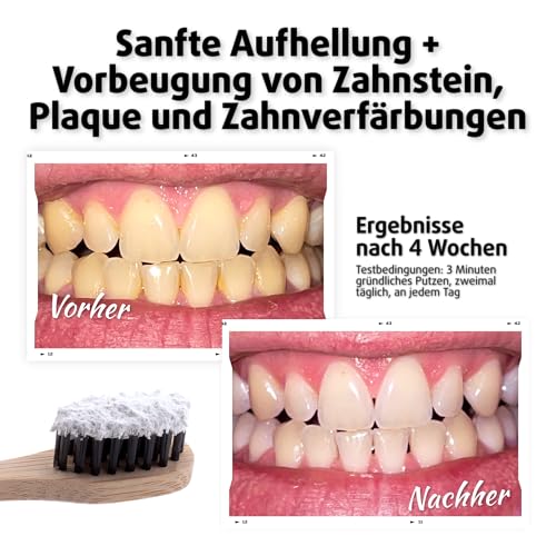 PearlSmile Teeth Whitening Powder - Zahnaufhellung Sehr Gut 2024-2025 - Zahnpulver für Weiße Zähne - Zahnbleaching & Aufhellung - Bleaching… – Ansicht 6