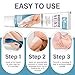 Hackerdom Varicose Veins Treatment for Legs, Varicose Veins Cream, Effectively Improves Blood Circulation, Relieves Leg Fatigue, Reduces Spider Veins