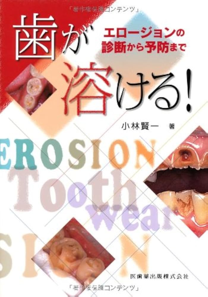 歯が溶ける! エロージョンの診断から予防まで | 小林 賢一 |本