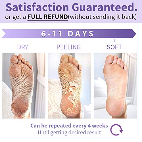 Foot Peel Mask 3 Pack, Dry Dead Skin Calluses Remover Exfoliating Repair Rough Cracked Heels for Baby Soft and Smooth… - Image 5