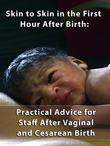 Skin to Skin in the First Hour After Birth: Practical Advice for Staff After Vaginal and Cesarean Birth