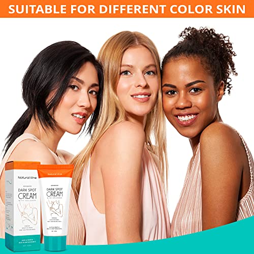 Dark Spot Corrector Cream, Dark Spot Remover For Body, Hyperpigmentation Treatment, Brightening Cream, Age Spot/Sun Spot/Brown Spot Treatment, Dark Spot Cream, Instant Result, Moisturizes Armpit, Neck, Knees And Private Parts, 2 Fl Oz/60Ml #TOP6