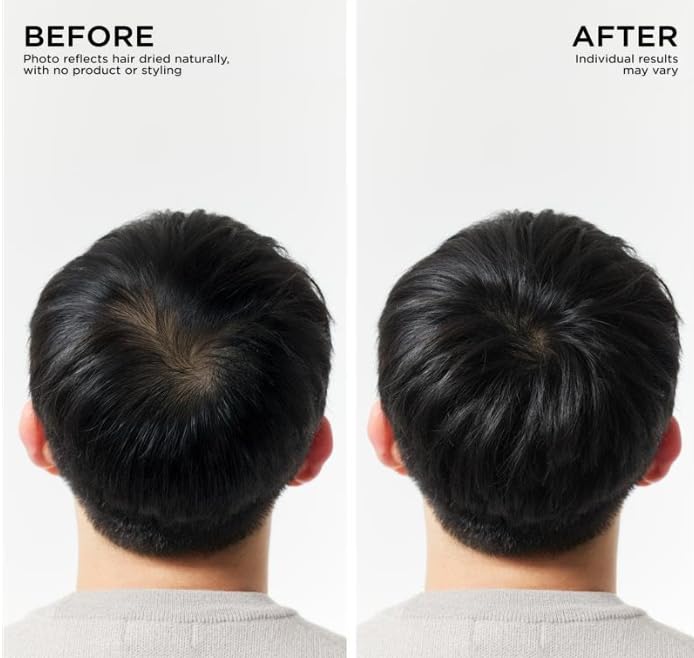 Dr Groot Scalp Revitalizing Solution Hair Thickening Shampoo, For All Scalp Types, Dermatologically Tested, Volumizing & Strengthening Formula, 700 ml (23.66 fl oz) Compare to Dr.ForHair & Revitalift