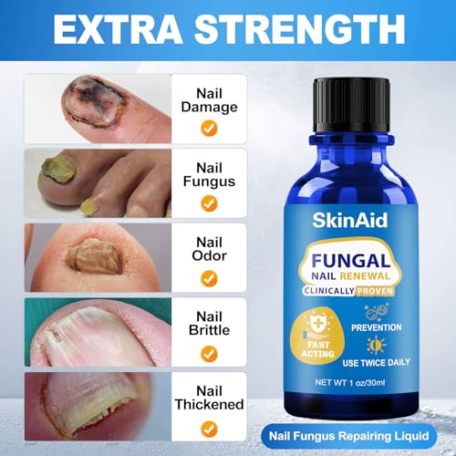 Toenail Fungus Treatment Extra Strength: Fungus Nail Treatment Fast Acting - Nail Fungal Treatment for Toenail and Fingernail - Nail Fungus Treatment for Men & Women - 30ML