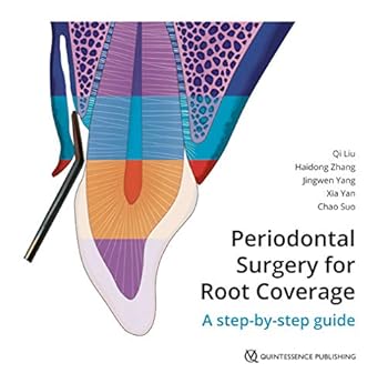 Hardcover Periodontal Surgery for Root Coverage Book