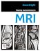 Planning and Positioning in MRI