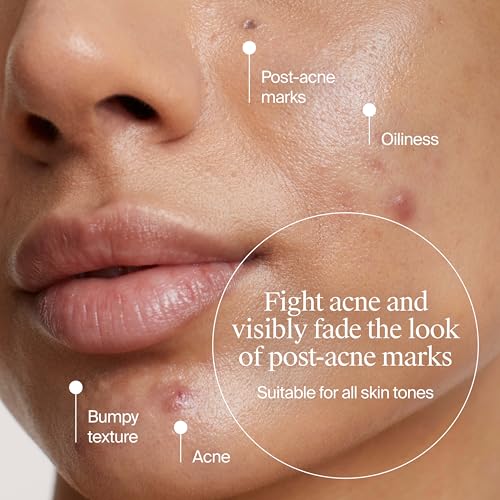 Neutrogena Evenly Clear Acne Cleanser, 9.1 fl. oz | 2% Salicylic Acid, 2% PHA Exfoliant, Gentle Foaming Face Wash, Clears Clogged Pores & Blackheads - image 3
