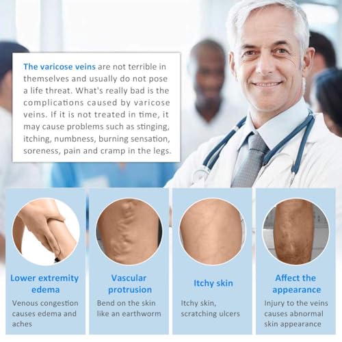 20-30mmhg compression pantyhose for women medical compression stockings high waist opaque compression tights for lymphadema edema swelling varicose veins support hose for teacher doctor